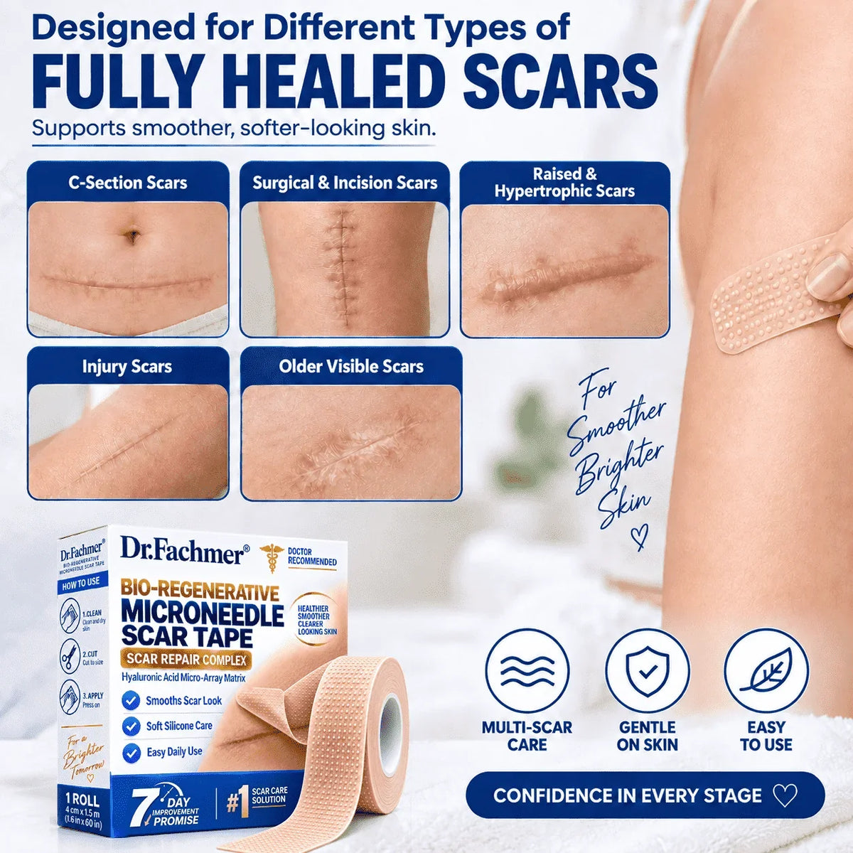 𝐎𝐟𝐟𝐢𝐜𝐢𝐚𝐥 𝐒𝐭𝐨𝐫𝐞 ②丨Mrevbsin® 🩹 Bio-Regenerative Microneedle Scar Tape——Remove all kinds of skin scars