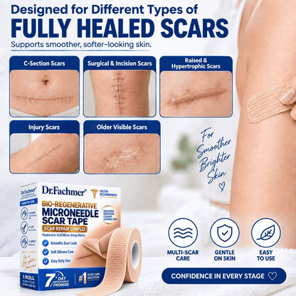 𝐎𝐟𝐟𝐢𝐜𝐢𝐚𝐥 𝐒𝐭𝐨𝐫𝐞 ②丨Mrevbsin® 🩹 Bio-Regenerative Microneedle Scar Tape——Remove all kinds of skin scars