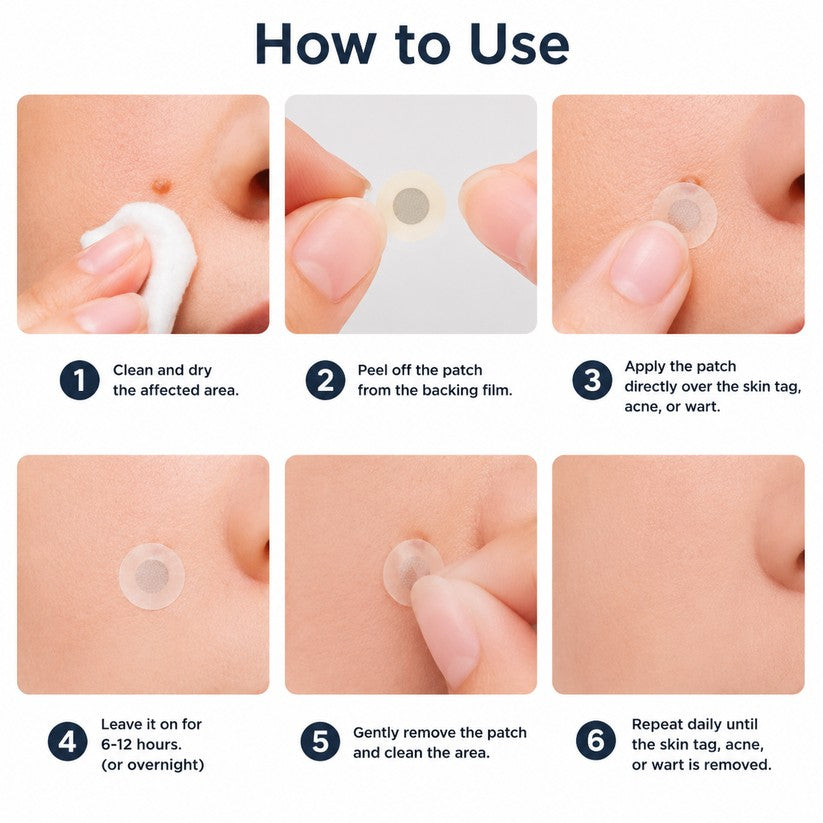 𝐎𝐟𝐟𝐢𝐜𝐢𝐚𝐥 𝐒𝐭𝐨𝐫𝐞 | Mrevbsin®  👩‍⚕️𝐁𝐨𝐭𝐚𝐧𝐢𝐜𝐚𝐥 𝐌𝐢𝐜𝐫𝐨𝐧𝐞𝐞𝐝𝐥𝐞 𝐇𝐲𝐝𝐫𝐨𝐜𝐨𝐥𝐥𝐨𝐢𝐝 𝐏𝐚𝐭𝐜𝐡 (𝐅𝐨𝐫 𝐒𝐤𝐢𝐧 𝐓𝐚𝐠𝐬, 𝐒𝐦𝐚𝐥𝐥 𝐒𝐤𝐢𝐧 𝐆𝐫𝐨𝐰𝐭𝐡𝐬, 𝐖𝐚𝐫𝐭𝐬, 𝐌𝐨𝐥𝐞𝐬, 𝐀𝐠𝐞 𝐒𝐩𝐨𝐭𝐬 & 𝐏𝐢𝐠𝐦𝐞𝐧𝐭𝐚𝐭𝐢𝐨𝐧 𝐂𝐨𝐧𝐜𝐞𝐫𝐧𝐬)