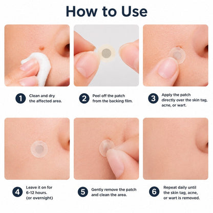 𝐎𝐟𝐟𝐢𝐜𝐢𝐚𝐥 𝐒𝐭𝐨𝐫𝐞 | Mrevbsin®  👩‍⚕️𝐁𝐨𝐭𝐚𝐧𝐢𝐜𝐚𝐥 𝐌𝐢𝐜𝐫𝐨𝐧𝐞𝐞𝐝𝐥𝐞 𝐇𝐲𝐝𝐫𝐨𝐜𝐨𝐥𝐥𝐨𝐢𝐝 𝐏𝐚𝐭𝐜𝐡 (𝐅𝐨𝐫 𝐒𝐤𝐢𝐧 𝐓𝐚𝐠𝐬, 𝐒𝐦𝐚𝐥𝐥 𝐒𝐤𝐢𝐧 𝐆𝐫𝐨𝐰𝐭𝐡𝐬, 𝐖𝐚𝐫𝐭𝐬, 𝐌𝐨𝐥𝐞𝐬, 𝐀𝐠𝐞 𝐒𝐩𝐨𝐭𝐬 & 𝐏𝐢𝐠𝐦𝐞𝐧𝐭𝐚𝐭𝐢𝐨𝐧 𝐂𝐨𝐧𝐜𝐞𝐫𝐧𝐬)
