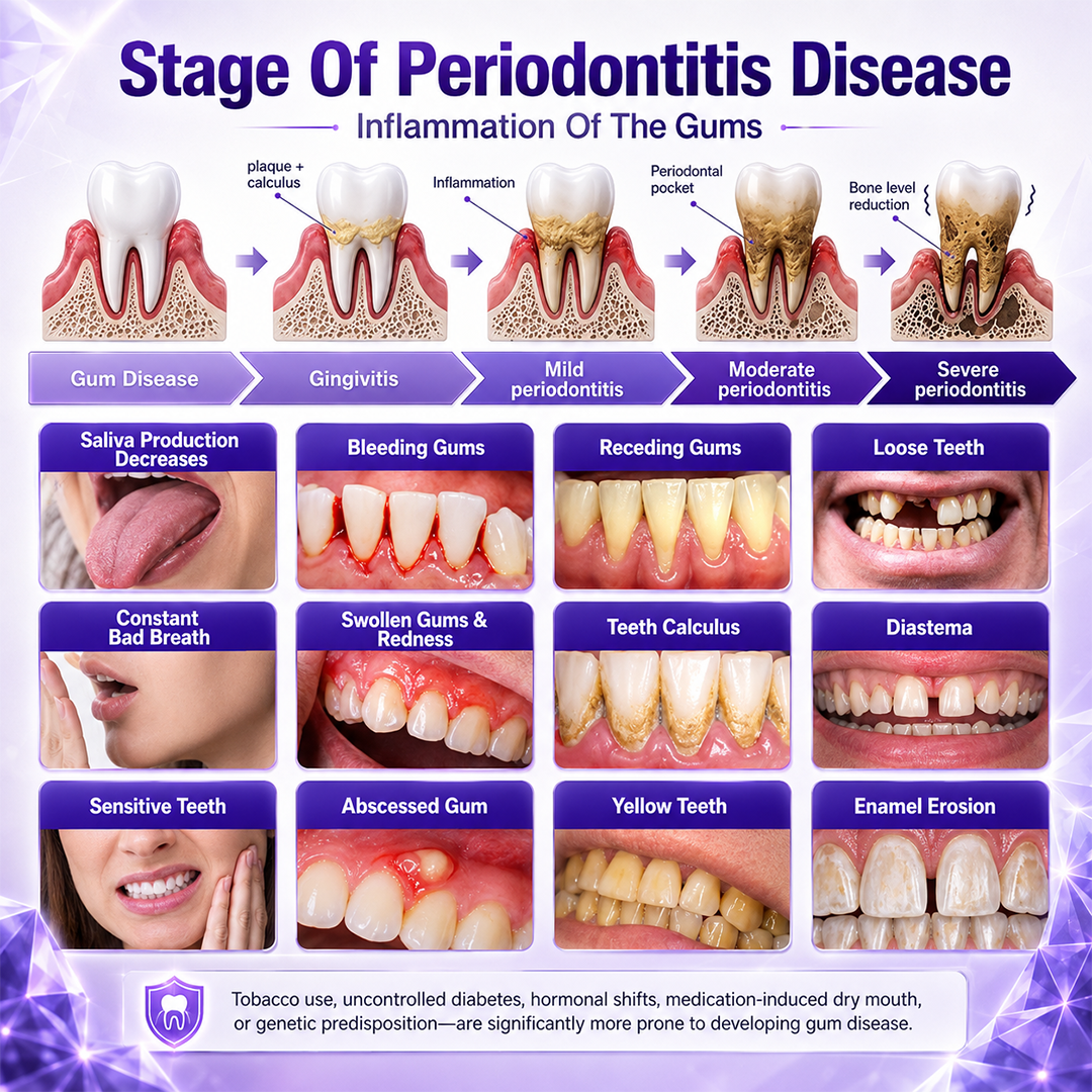 Billhol®📢 Gingivitis Periodontal Treatment Toothpaste✨
