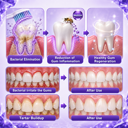 Billhol®📢 Gingivitis Periodontal Treatment Toothpaste✨