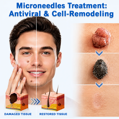 𝐎𝐟𝐟𝐢𝐜𝐢𝐚𝐥 𝐒𝐭𝐨𝐫𝐞 | Mrevbsin®  👩‍⚕️𝐁𝐨𝐭𝐚𝐧𝐢𝐜𝐚𝐥 𝐌𝐢𝐜𝐫𝐨𝐧𝐞𝐞𝐝𝐥𝐞 𝐇𝐲𝐝𝐫𝐨𝐜𝐨𝐥𝐥𝐨𝐢𝐝 𝐏𝐚𝐭𝐜𝐡 (𝐅𝐨𝐫 𝐒𝐤𝐢𝐧 𝐓𝐚𝐠𝐬, 𝐒𝐦𝐚𝐥𝐥 𝐒𝐤𝐢𝐧 𝐆𝐫𝐨𝐰𝐭𝐡𝐬, 𝐖𝐚𝐫𝐭𝐬, 𝐌𝐨𝐥𝐞𝐬, 𝐀𝐠𝐞 𝐒𝐩𝐨𝐭𝐬 & 𝐏𝐢𝐠𝐦𝐞𝐧𝐭𝐚𝐭𝐢𝐨𝐧 𝐂𝐨𝐧𝐜𝐞𝐫𝐧𝐬)