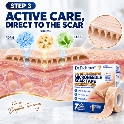 𝐎𝐟𝐟𝐢𝐜𝐢𝐚𝐥 𝐒𝐭𝐨𝐫𝐞 ②丨Mrevbsin® 🩹 Bio-Regenerative Microneedle Scar Tape——Remove all kinds of skin scars