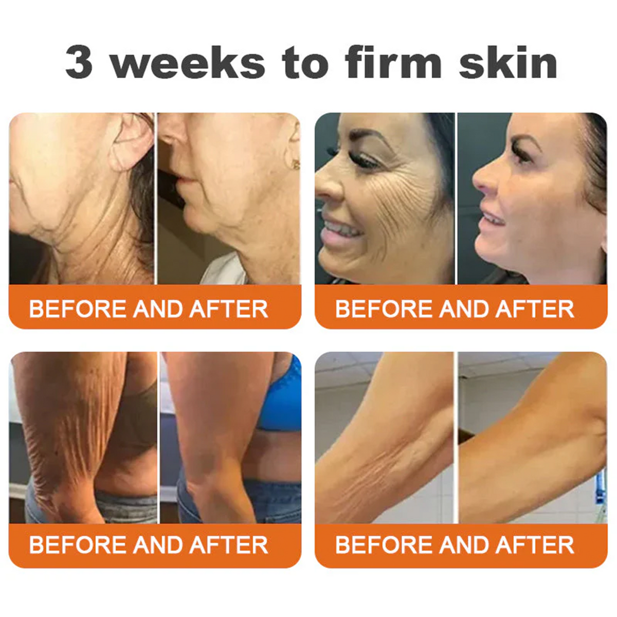 🔥Official Brand Shop丨Mrevbsin® Bee venom Pro Comprehensive Cream—Tightening for Skin Types