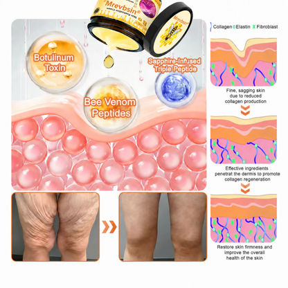 🔥Official Brand Shop丨Mrevbsin® Bee venom Pro Comprehensive Cream—Tightening for Skin Types