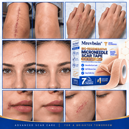 𝐎𝐟𝐟𝐢𝐜𝐢𝐚𝐥 𝐒𝐭𝐨𝐫𝐞 ①丨Mrevbsin® 🩹 Bio-Regenerative Microneedle Scar Tape——Remove all kinds of skin scars