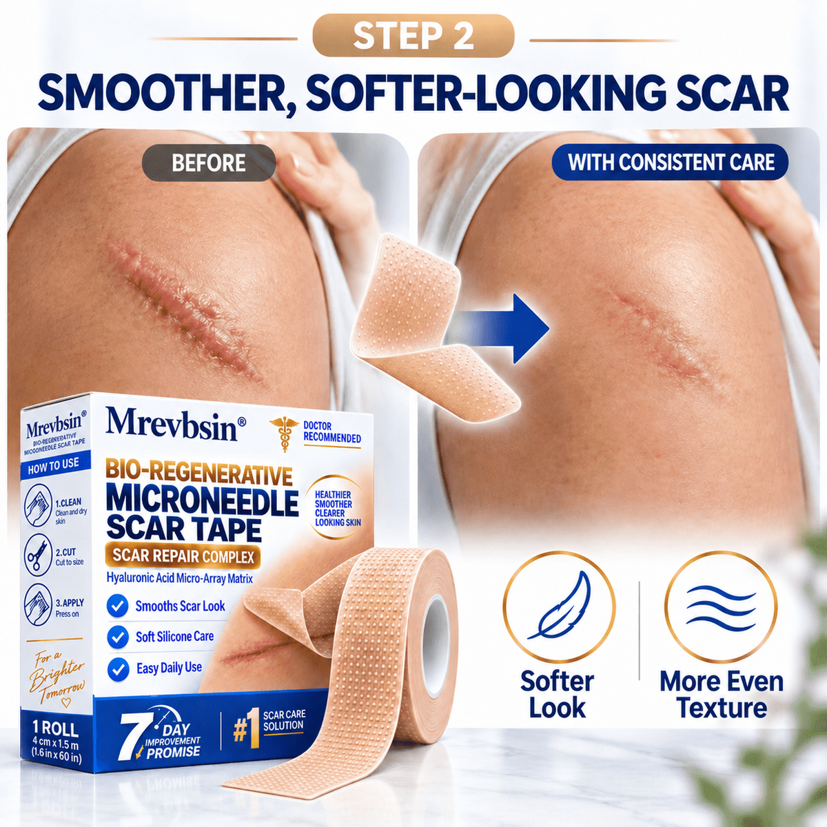 𝐎𝐟𝐟𝐢𝐜𝐢𝐚𝐥 𝐒𝐭𝐨𝐫𝐞 ①丨Mrevbsin® 🩹 Bio-Regenerative Microneedle Scar Tape——Remove all kinds of skin scars