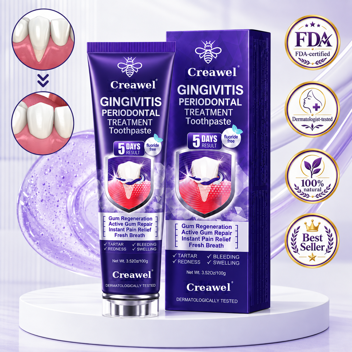 Creawel® Gingivitis Periodontal Treatment Toothpaste
