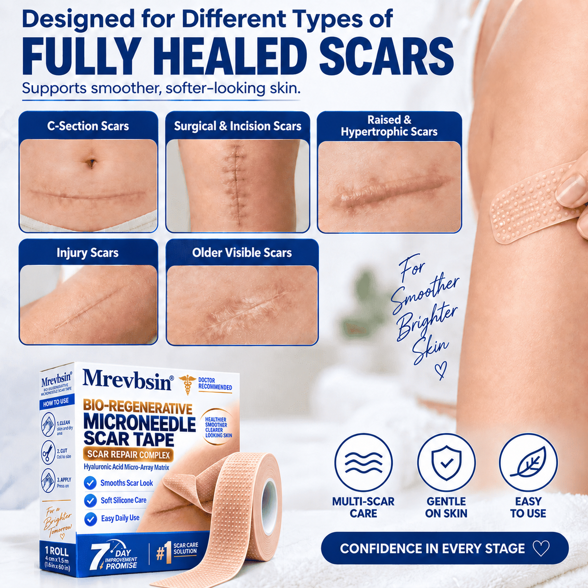 𝐎𝐟𝐟𝐢𝐜𝐢𝐚𝐥 𝐒𝐭𝐨𝐫𝐞 ①丨Mrevbsin® 🩹 Bio-Regenerative Microneedle Scar Tape——Remove all kinds of skin scars