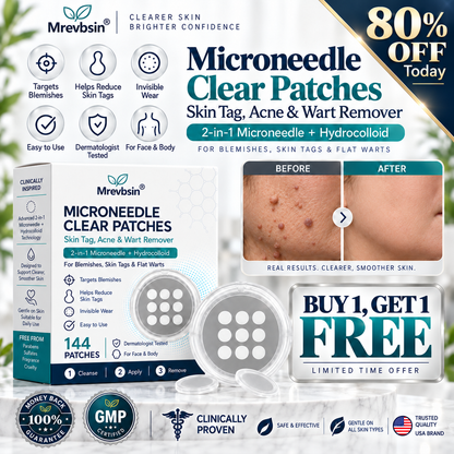 𝐎𝐟𝐟𝐢𝐜𝐢𝐚𝐥 𝐒𝐭𝐨𝐫𝐞 | Mrevbsin®  👩‍⚕️𝐁𝐨𝐭𝐚𝐧𝐢𝐜𝐚𝐥 𝐌𝐢𝐜𝐫𝐨𝐧𝐞𝐞𝐝𝐥𝐞 𝐇𝐲𝐝𝐫𝐨𝐜𝐨𝐥𝐥𝐨𝐢𝐝 𝐏𝐚𝐭𝐜𝐡 (𝐅𝐨𝐫 𝐒𝐤𝐢𝐧 𝐓𝐚𝐠𝐬, 𝐒𝐦𝐚𝐥𝐥 𝐒𝐤𝐢𝐧 𝐆𝐫𝐨𝐰𝐭𝐡𝐬, 𝐖𝐚𝐫𝐭𝐬, 𝐌𝐨𝐥𝐞𝐬, 𝐀𝐠𝐞 𝐒𝐩𝐨𝐭𝐬 & 𝐏𝐢𝐠𝐦𝐞𝐧𝐭𝐚𝐭𝐢𝐨𝐧 𝐂𝐨𝐧𝐜𝐞𝐫𝐧𝐬)