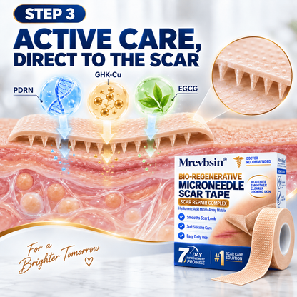 𝐎𝐟𝐟𝐢𝐜𝐢𝐚𝐥 𝐒𝐭𝐨𝐫𝐞 ①丨Mrevbsin® 🩹 Bio-Regenerative Microneedle Scar Tape——Remove all kinds of skin scars