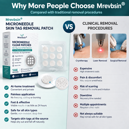 𝐎𝐟𝐟𝐢𝐜𝐢𝐚𝐥 𝐒𝐭𝐨𝐫𝐞 | Mrevbsin®  👩‍⚕️𝐁𝐨𝐭𝐚𝐧𝐢𝐜𝐚𝐥 𝐌𝐢𝐜𝐫𝐨𝐧𝐞𝐞𝐝𝐥𝐞 𝐇𝐲𝐝𝐫𝐨𝐜𝐨𝐥𝐥𝐨𝐢𝐝 𝐏𝐚𝐭𝐜𝐡 (𝐅𝐨𝐫 𝐒𝐤𝐢𝐧 𝐓𝐚𝐠𝐬, 𝐒𝐦𝐚𝐥𝐥 𝐒𝐤𝐢𝐧 𝐆𝐫𝐨𝐰𝐭𝐡𝐬, 𝐖𝐚𝐫𝐭𝐬, 𝐌𝐨𝐥𝐞𝐬, 𝐀𝐠𝐞 𝐒𝐩𝐨𝐭𝐬 & 𝐏𝐢𝐠𝐦𝐞𝐧𝐭𝐚𝐭𝐢𝐨𝐧 𝐂𝐨𝐧𝐜𝐞𝐫𝐧𝐬)